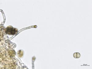 Stemphylium_sp_6