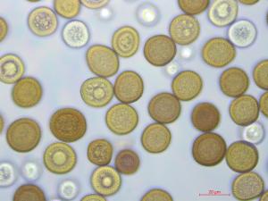 Tilletia_maclaganii_2