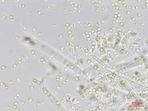 Trichoderma_virens_2