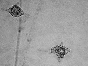 Pythium_irregulare_2