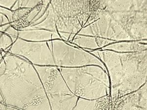 Verticillium_dahliae_1