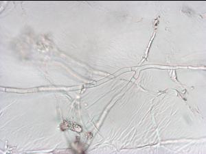 Sclerotium cepivorum