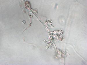 Sclerotium cepivorum conidiophores