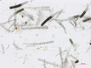 Chlamydospores et conidies de Berkeleyomyces basicola (syn. Thielaviopsis basicola)