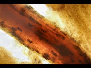 Berkeleyomyces basicola (syn. Thielaviopsis basicola) racine laitue