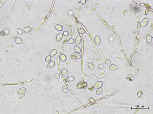 Phytophthora infestans - sporange