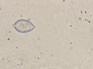 Phytophthora infestans - sporange