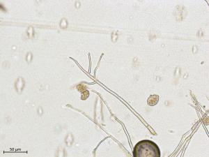 Phytophthora infestans - sporange