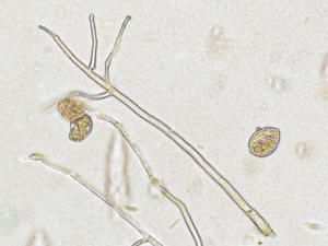 Phytophthora infestans - sporange