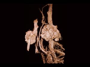 Pomme - Tumeur du collet (Agrobacterium tumefaciens)