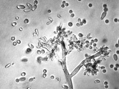 Botrytis_allii-05_LQ