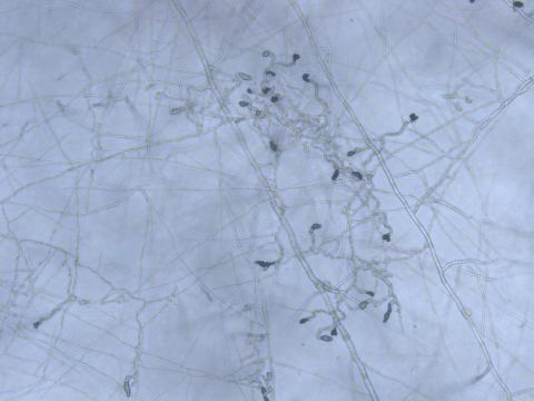 Colletotrichum_Appressoria_D50604-1