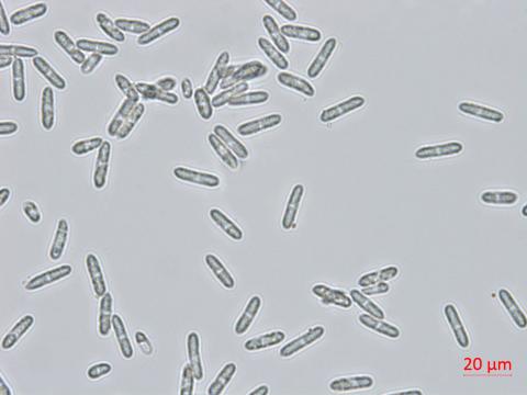 Colletotrichum_coccodes_D35079-3_LQ