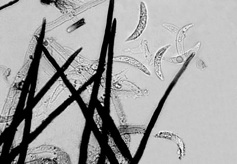 Colletotrichum_graminicola-04_LQ