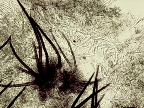 Colletotrichum_truncatum-10