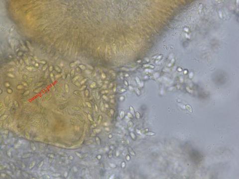 Coniella-vitis_D45881_vigne