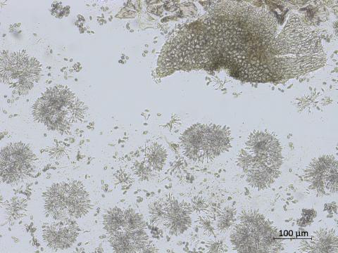 Coniella_diplodiella_D33070-2