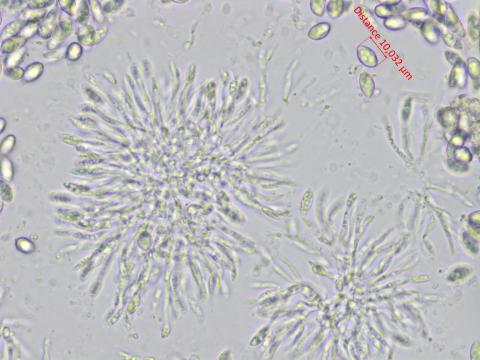 Coniella_diplodiella_D33070-4