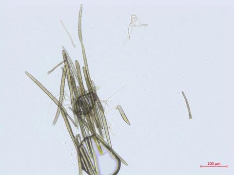 Corynespora_cassiicola_D55060-1_Conidie_LQ