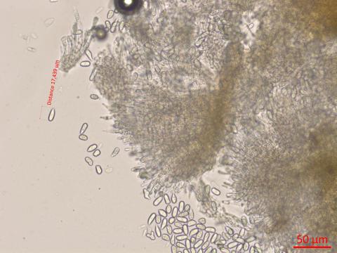 Cryptosporiopsis_tarraconensis_D42630_Conidiophores_Conidies