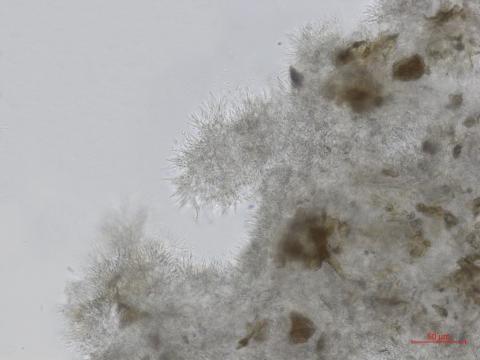 Cytospora_leucostoma_D44677-1_Conidiophores_LQ