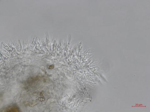 Cytospora_leucostoma_D44677-2_Conidiophores_LQ