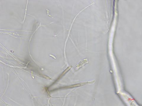 Dictyochaeta_D34357-2_LQ