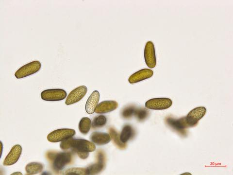 Diplodia_seriata_D43390-2_Conidies_LQ