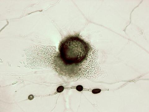 ascochyta_medicaginicola-01-ret