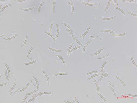 Fusarium_oxysporum_3