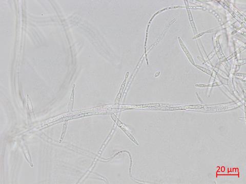 Fusarium_proliferatum_3