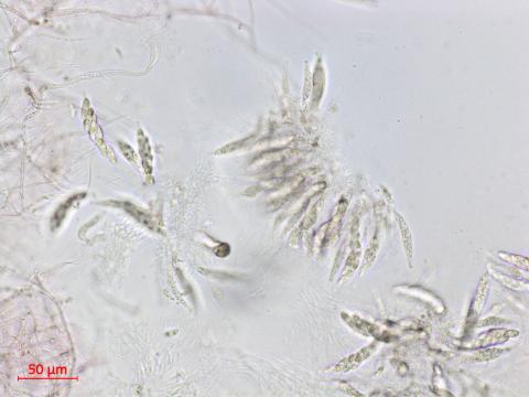 Glomerella_sp_2