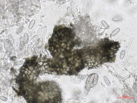 Leptosphaerulina_sp_1