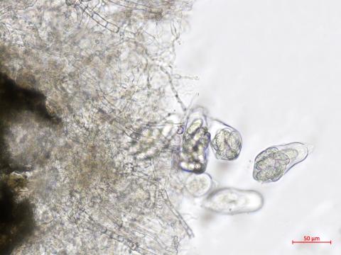 Leptosphaerulina_sp_2