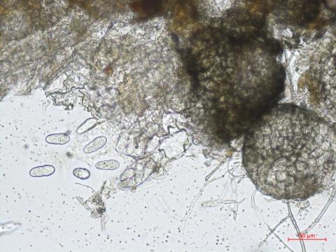 Leptosphaerulina_sp_5