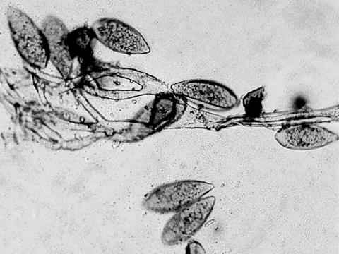 Peronospora_destructor_1