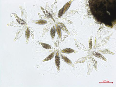 Physalospora_sp_2