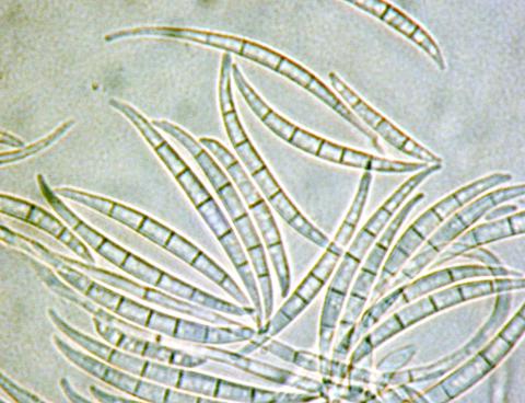 Fusarium_acuminatum_2