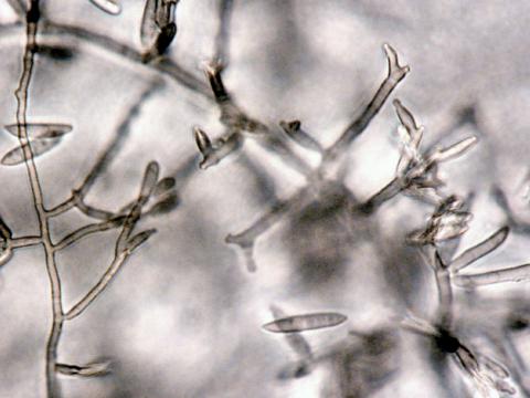 Fusarium_camptoceras_2