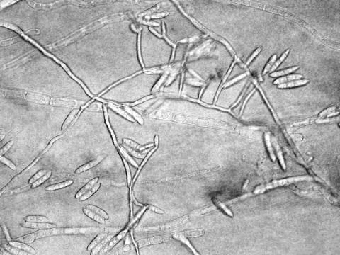 Fusarium_camptoceras_1