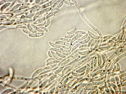 Bisifusarium_dimerum_1
