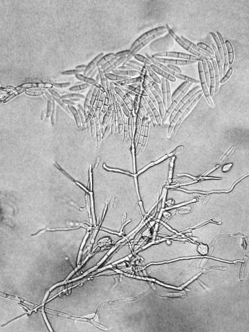 Fusarium_proliferatum_2