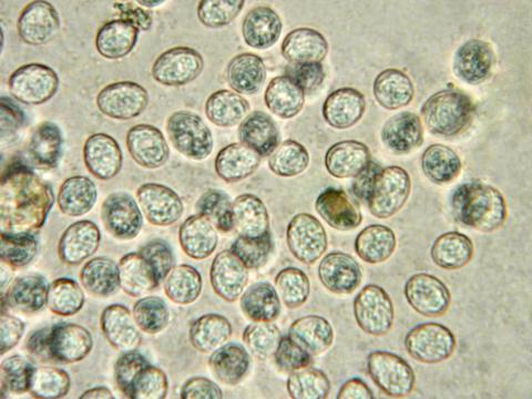 Phyllosticta_ampelicida_2