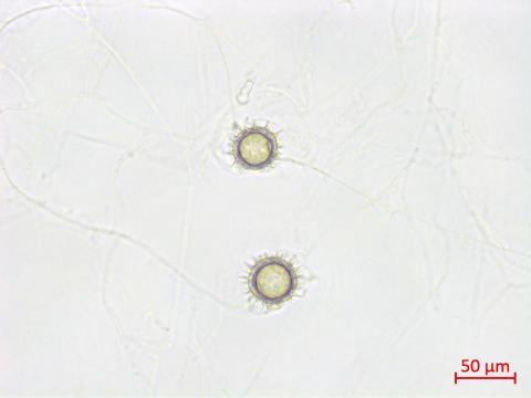 Pythium_uncinulatum_2