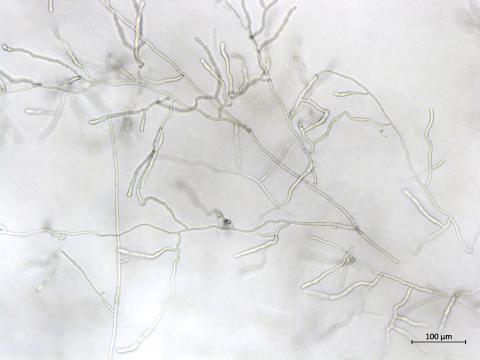 Rhizoctonia_sp_5