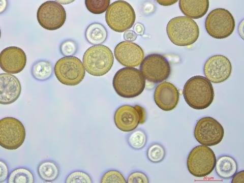 Tilletia_maclaganii_3