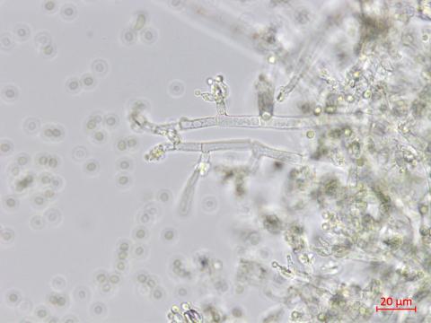 Trichoderma_virens_1