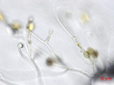 Ulocladium_sp_3