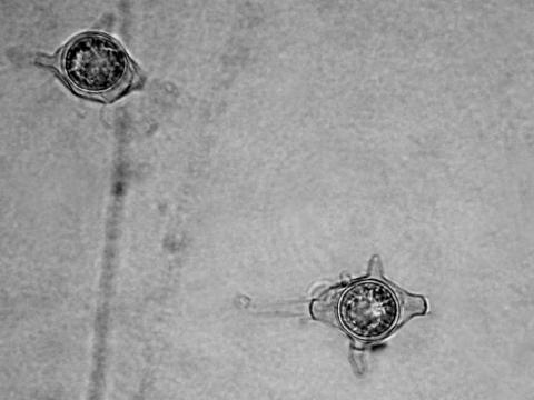 Pythium_irregulare_2