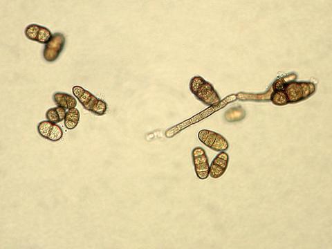 Ulocladium_sp_5